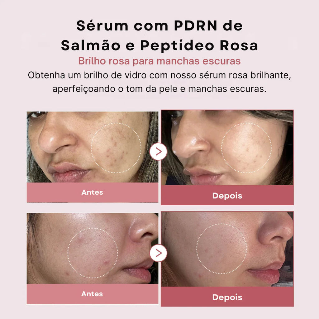 Medicube Sérum PDRN Peptide Pink