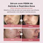 Medicube Sérum PDRN Peptide Pink