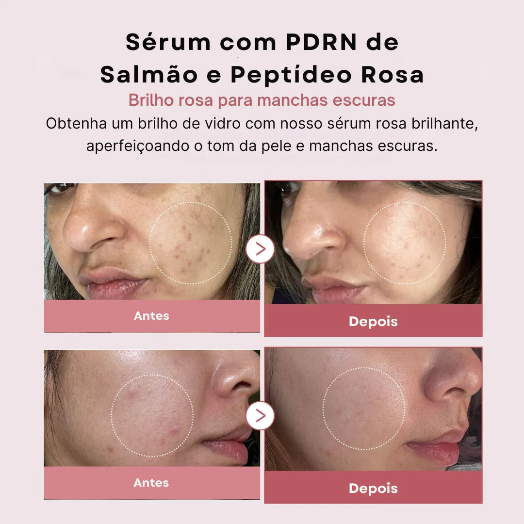 Medicube Sérum PDRN Peptide Pink